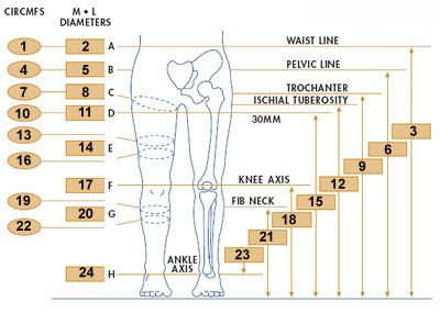 Computer Repair Nashville on Women Wearing Kafos  Kafo Brace For Sale    Orthotic Device Kafo